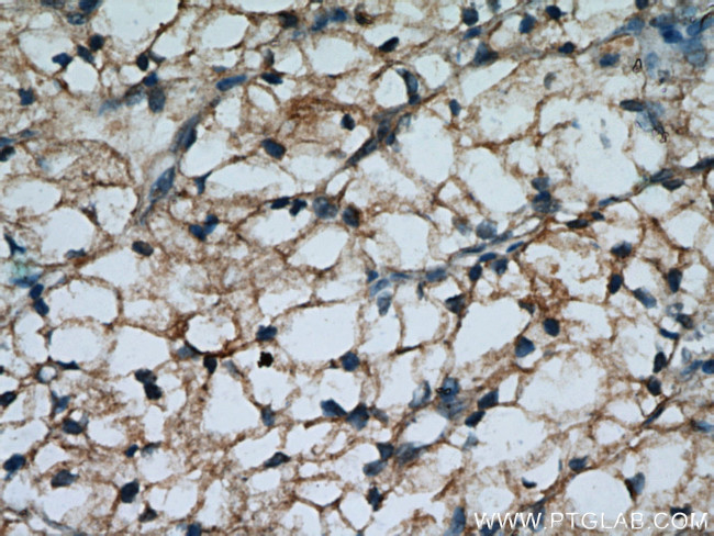 MME/CD10 Antibody in Immunohistochemistry (Paraffin) (IHC (P))