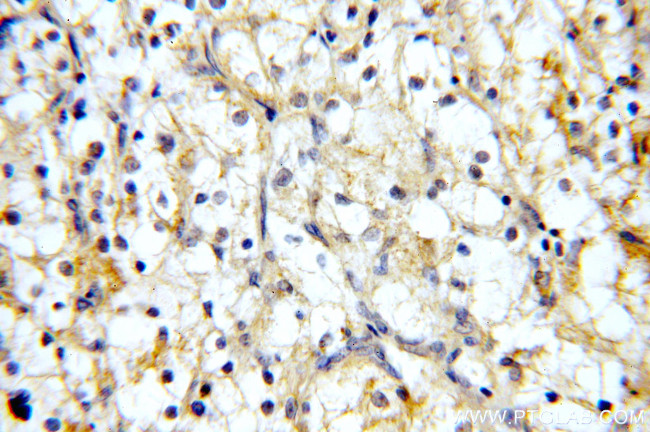 MME/CD10 Antibody in Immunohistochemistry (Paraffin) (IHC (P))