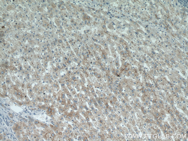 MME/CD10 Antibody in Immunohistochemistry (Paraffin) (IHC (P))