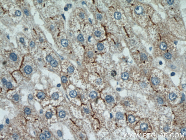 MME/CD10 Antibody in Immunohistochemistry (Paraffin) (IHC (P))