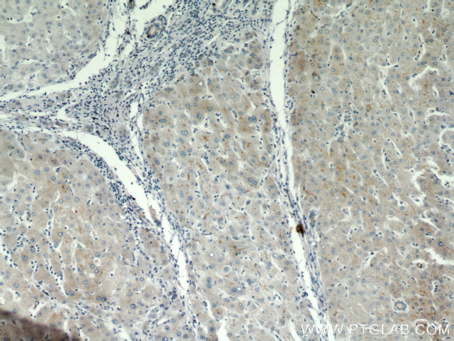 MME/CD10 Antibody in Immunohistochemistry (Paraffin) (IHC (P))