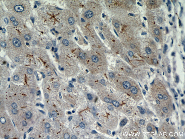 MME/CD10 Antibody in Immunohistochemistry (Paraffin) (IHC (P))