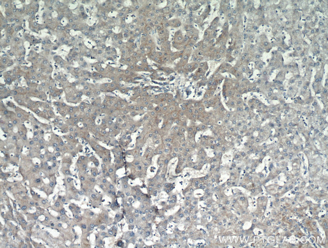 MME/CD10 Antibody in Immunohistochemistry (Paraffin) (IHC (P))