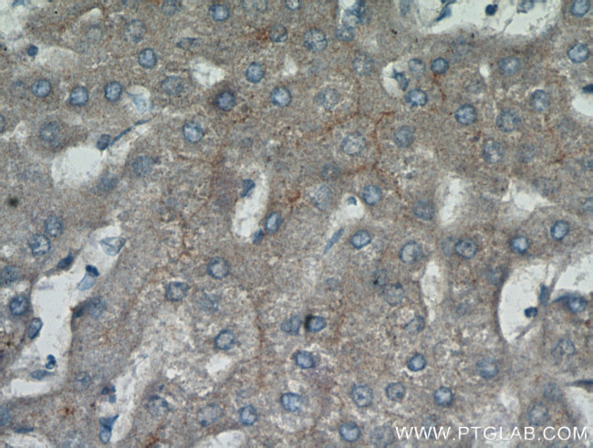 MME/CD10 Antibody in Immunohistochemistry (Paraffin) (IHC (P))