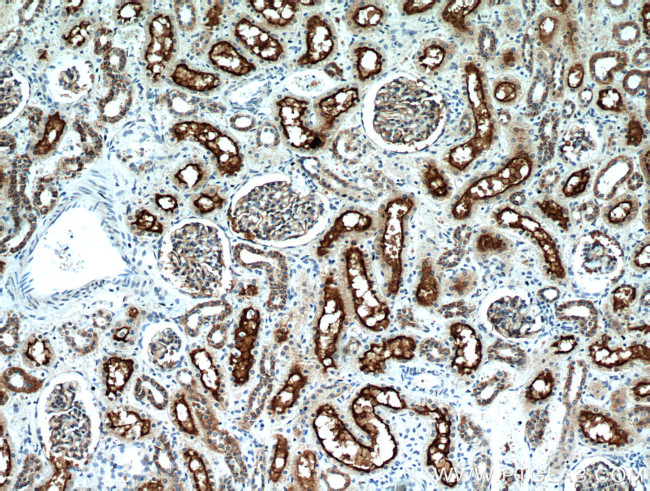 MME/CD10 Antibody in Immunohistochemistry (Paraffin) (IHC (P))