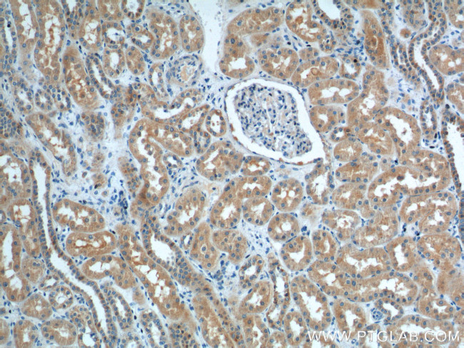 SNX1 Antibody in Immunohistochemistry (Paraffin) (IHC (P))