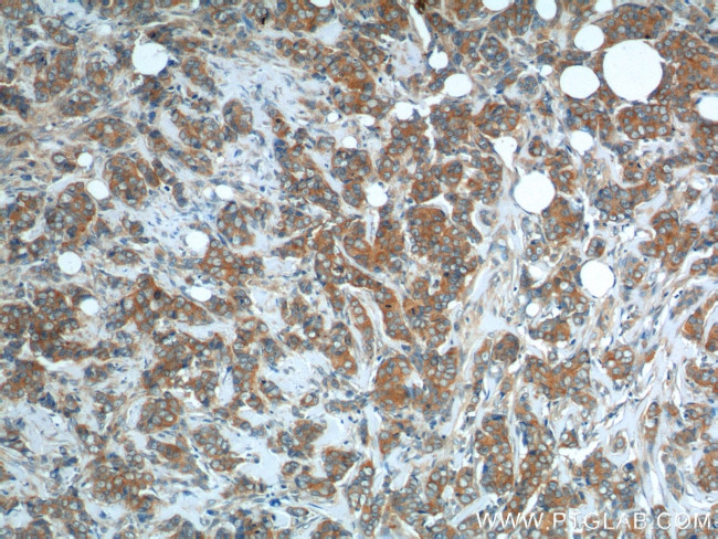 SNX1 Antibody in Immunohistochemistry (Paraffin) (IHC (P))