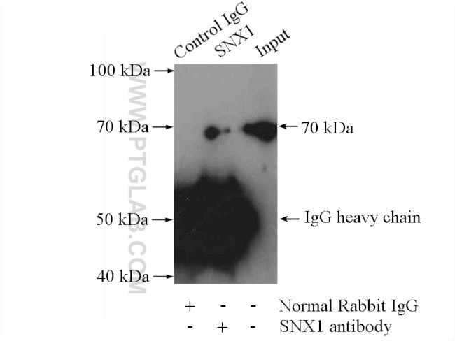 SNX1 Antibody in Immunoprecipitation (IP)