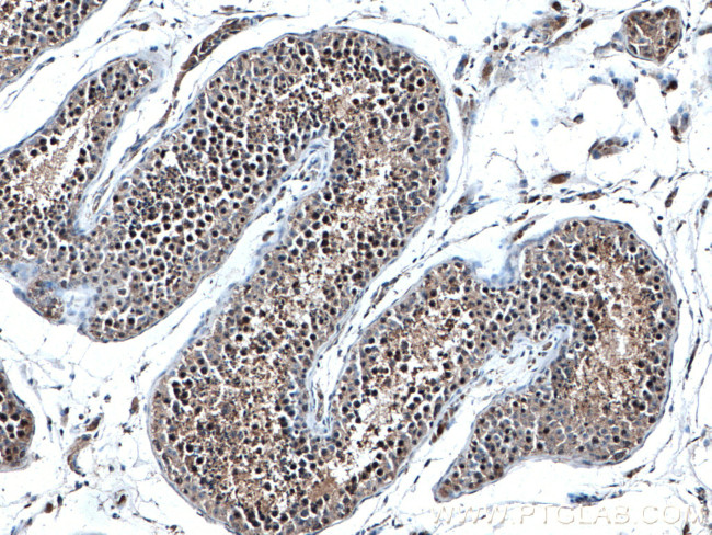 PLK1 Antibody in Immunohistochemistry (Paraffin) (IHC (P))