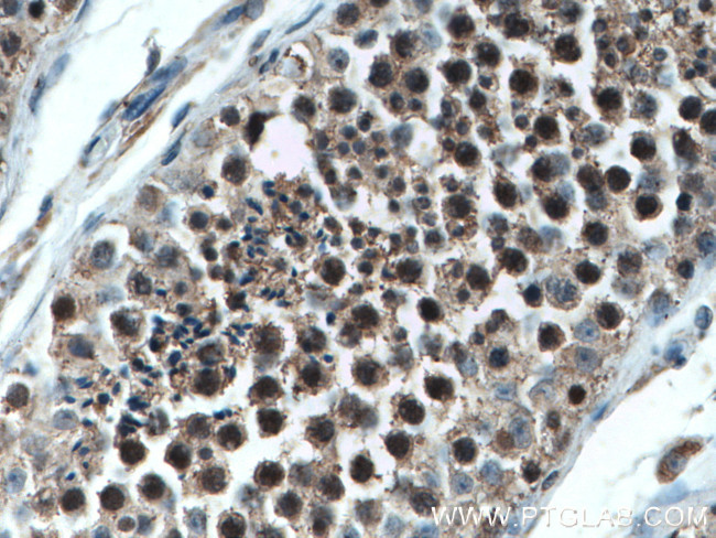 PLK1 Antibody in Immunohistochemistry (Paraffin) (IHC (P))