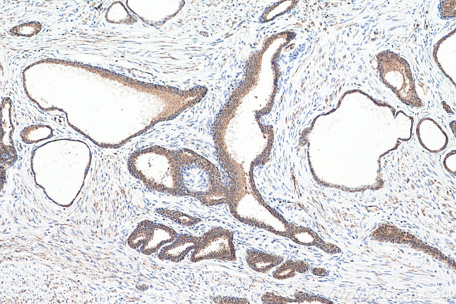 PLK1 Antibody in Immunohistochemistry (Paraffin) (IHC (P))