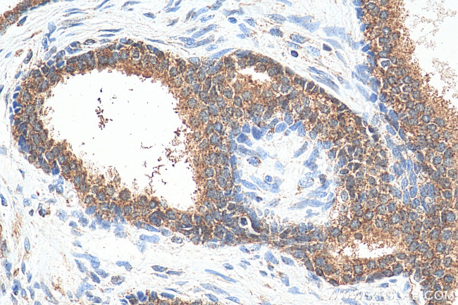 PLK1 Antibody in Immunohistochemistry (Paraffin) (IHC (P))