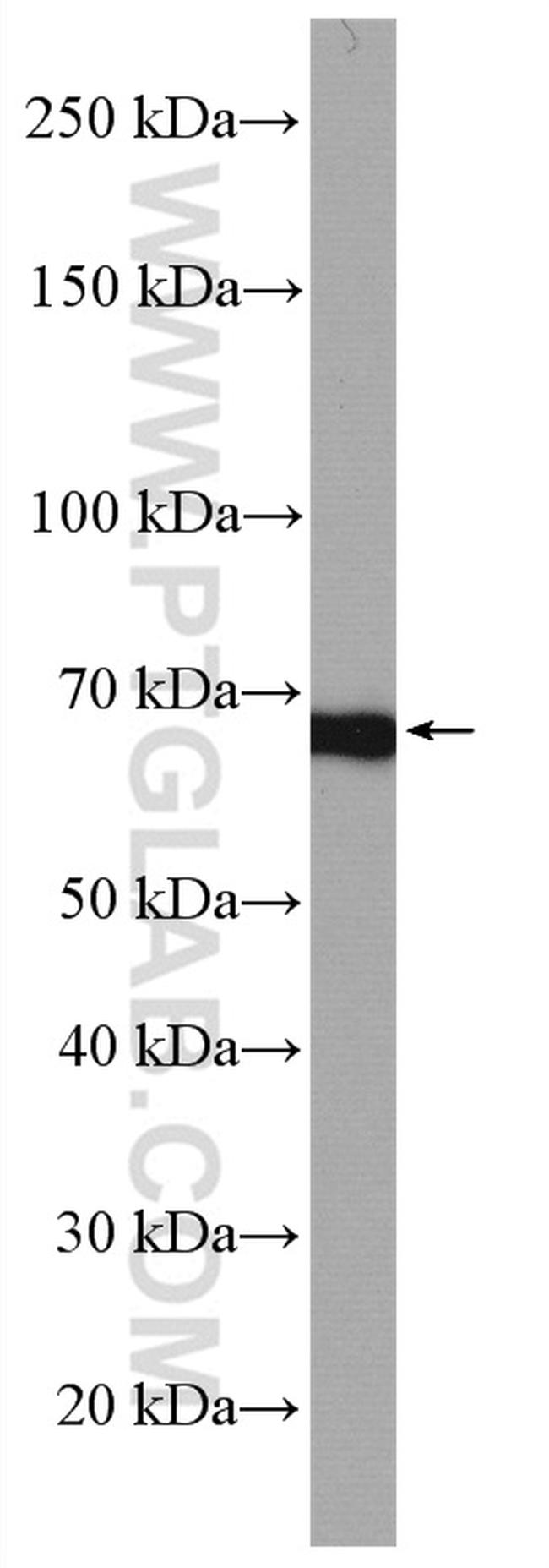 PLK1 Antibody in Western Blot (WB)