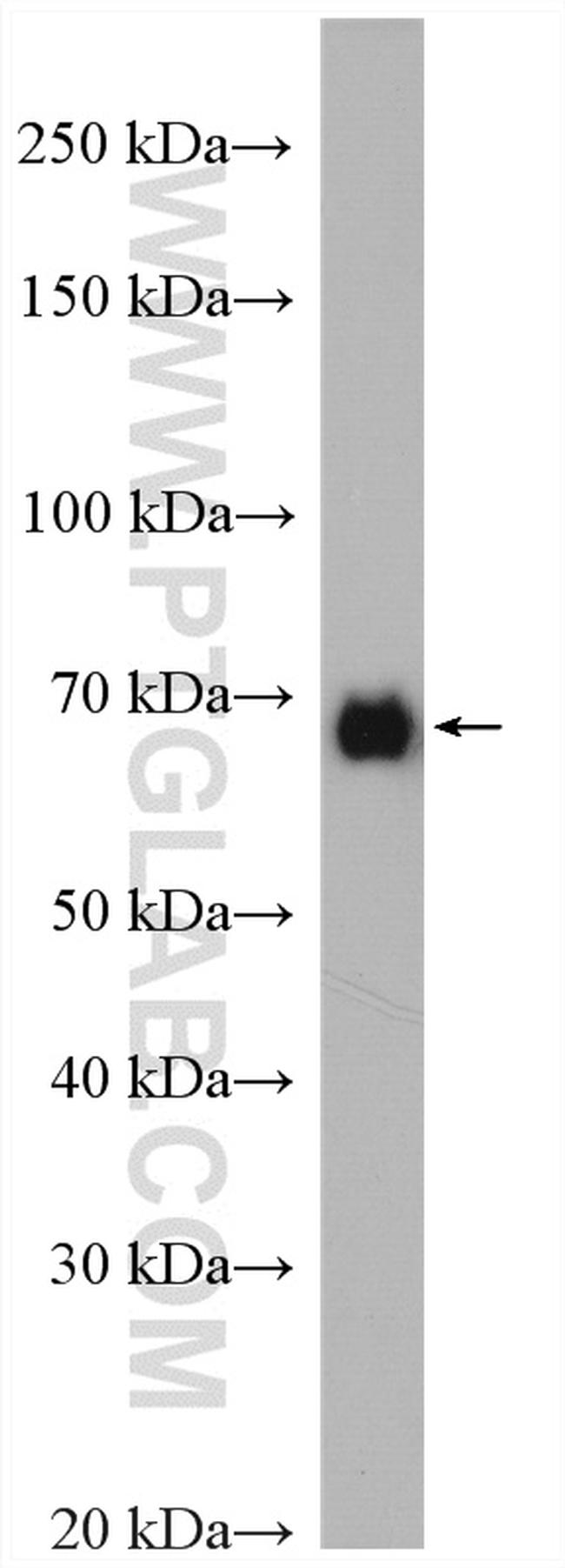 PLK1 Antibody in Western Blot (WB)