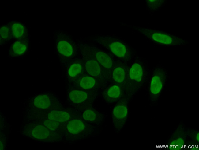 B23/NPM1 Antibody in Immunocytochemistry (ICC/IF)