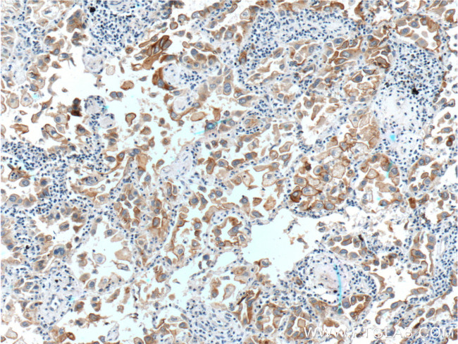 GPRC5A/RAI3 Antibody in Immunohistochemistry (Paraffin) (IHC (P))