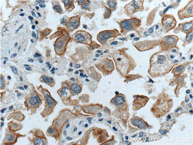 GPRC5A/RAI3 Antibody in Immunohistochemistry (Paraffin) (IHC (P))