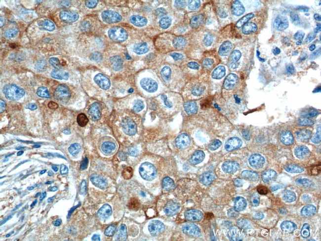 GPRC5A/RAI3 Antibody in Immunohistochemistry (Paraffin) (IHC (P))