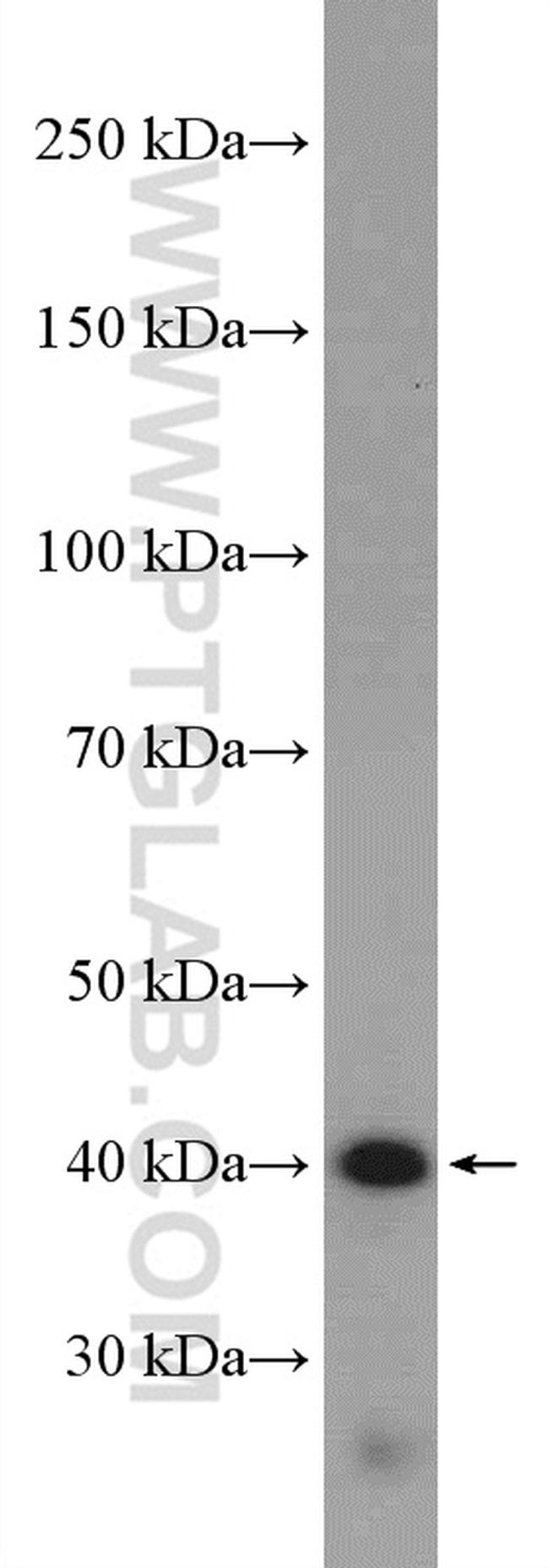 GPRC5A/RAI3 Antibody in Western Blot (WB)