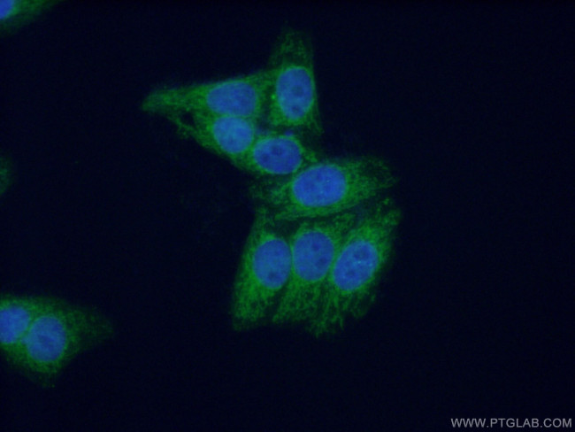 MPV17 Antibody in Immunocytochemistry (ICC/IF)