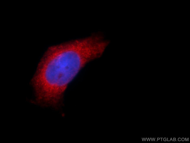 MPV17 Antibody in Immunocytochemistry (ICC/IF)