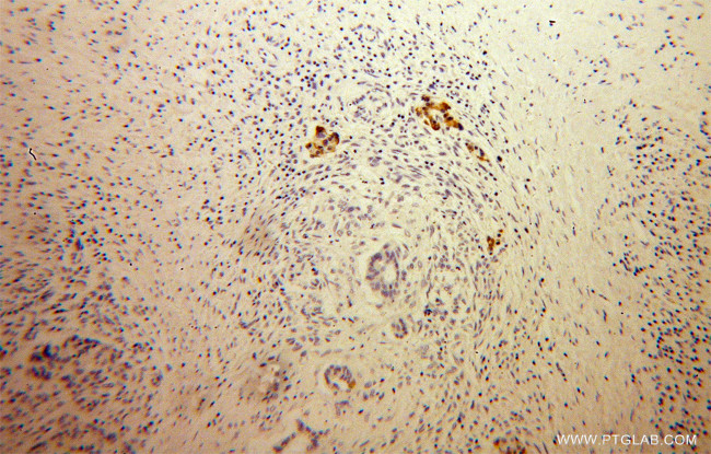 MPV17 Antibody in Immunohistochemistry (Paraffin) (IHC (P))