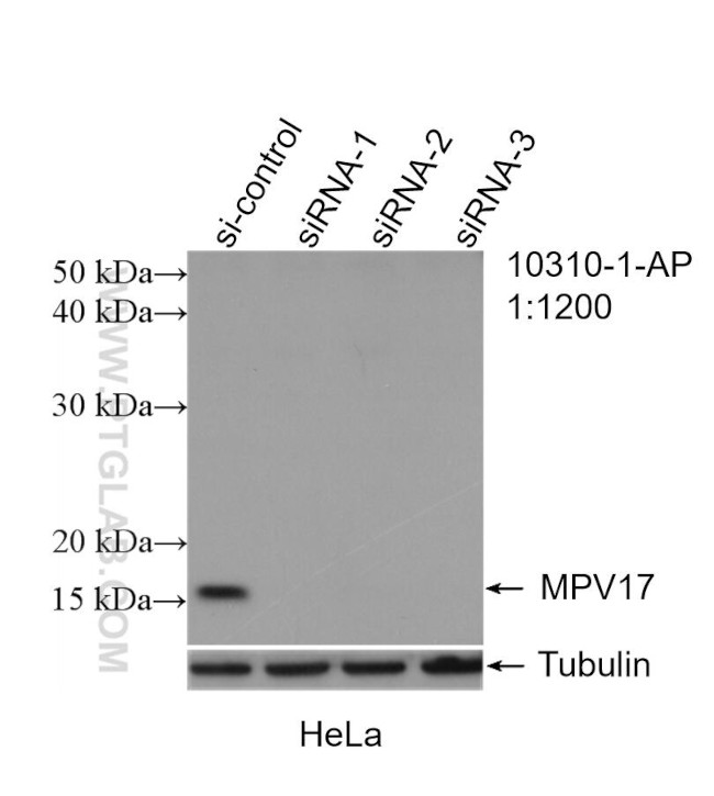 MPV17 Antibody in Western Blot (WB)