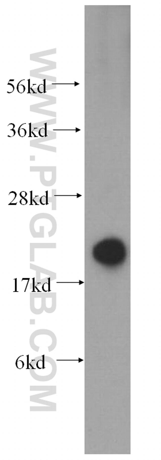 MPV17 Antibody in Western Blot (WB)