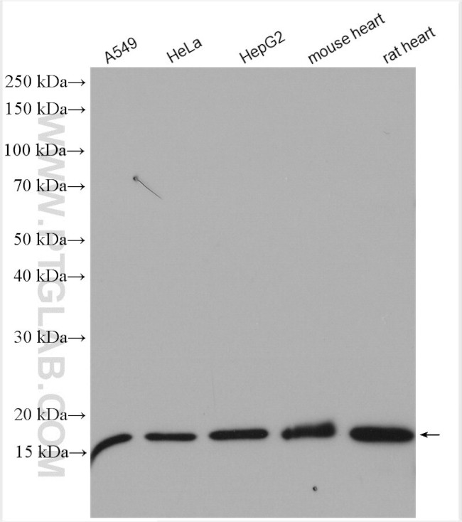 MPV17 Antibody in Western Blot (WB)