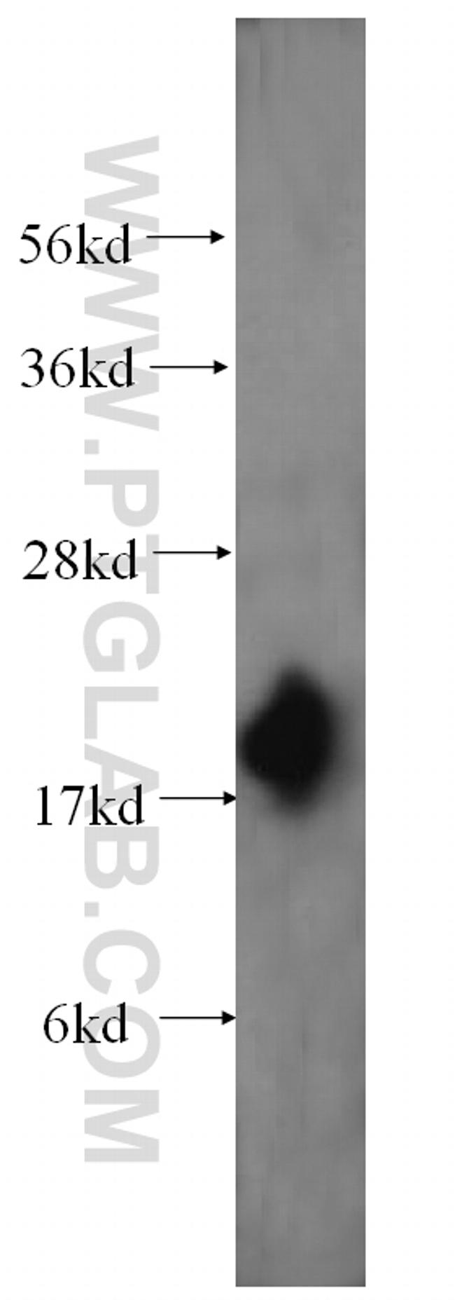 MPV17 Antibody in Western Blot (WB)