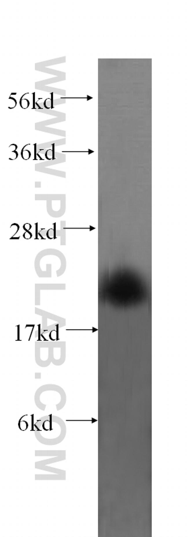 MPV17 Antibody in Western Blot (WB)