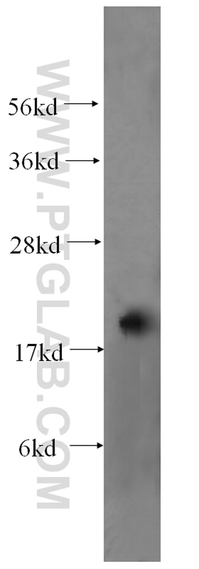 MPV17 Antibody in Western Blot (WB)