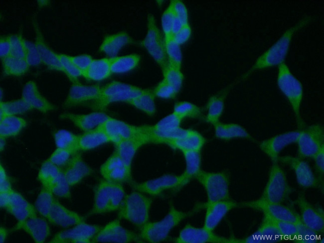 CNOT2 Antibody in Immunocytochemistry (ICC/IF)