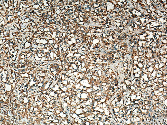 Stanniocalcin 2 Antibody in Immunohistochemistry (Paraffin) (IHC (P))