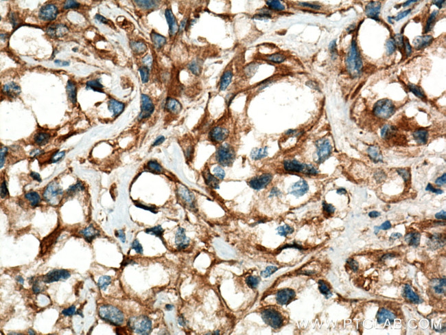 Stanniocalcin 2 Antibody in Immunohistochemistry (Paraffin) (IHC (P))