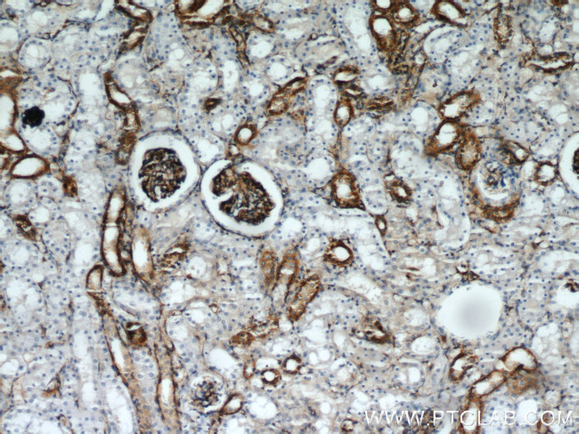 Stanniocalcin 2 Antibody in Immunohistochemistry (Paraffin) (IHC (P))