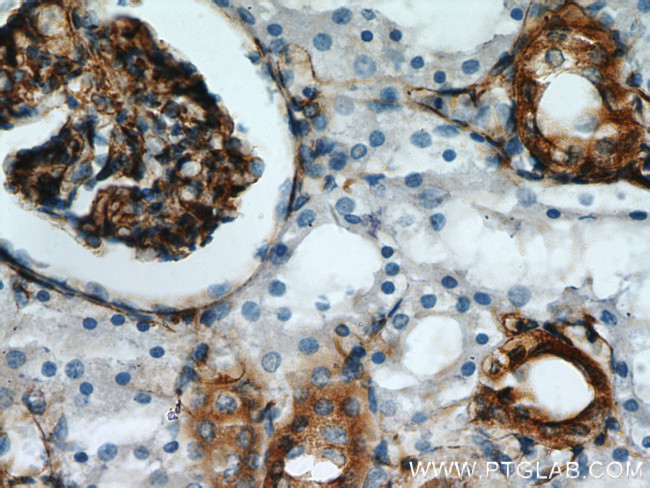 Stanniocalcin 2 Antibody in Immunohistochemistry (Paraffin) (IHC (P))