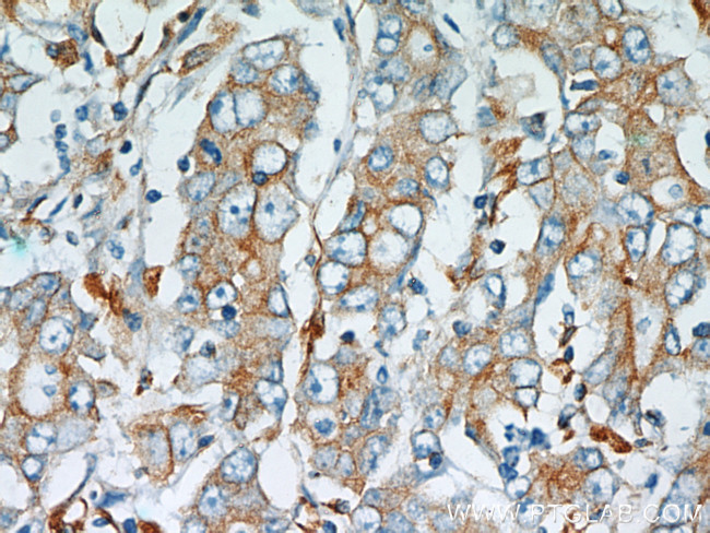 Stanniocalcin 2 Antibody in Immunohistochemistry (Paraffin) (IHC (P))