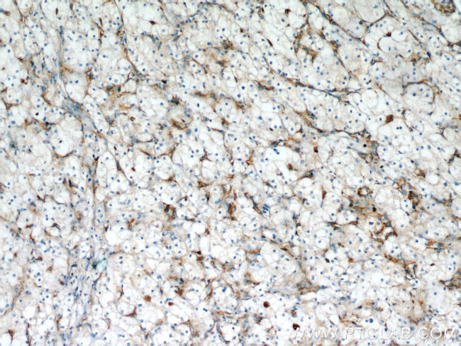 Stanniocalcin 2 Antibody in Immunohistochemistry (Paraffin) (IHC (P))