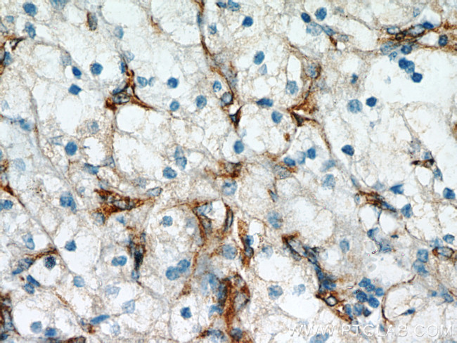 Stanniocalcin 2 Antibody in Immunohistochemistry (Paraffin) (IHC (P))