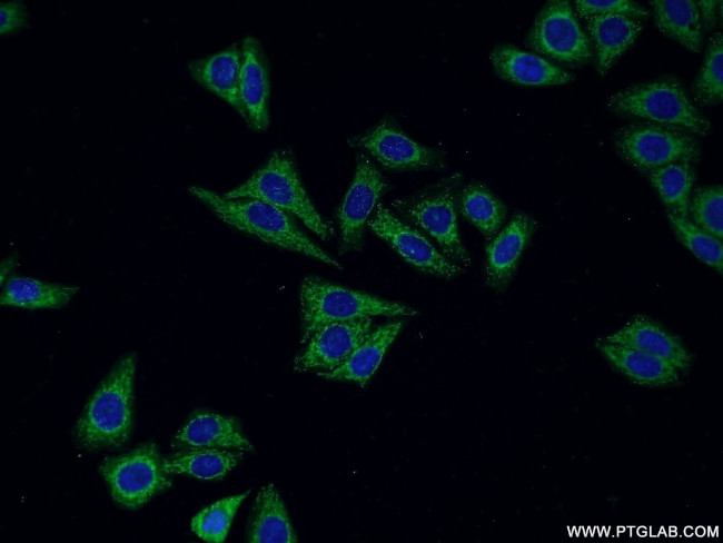 Cathepsin H Antibody in Immunocytochemistry (ICC/IF)