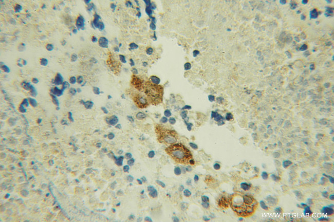 Cathepsin H Antibody in Immunohistochemistry (Paraffin) (IHC (P))