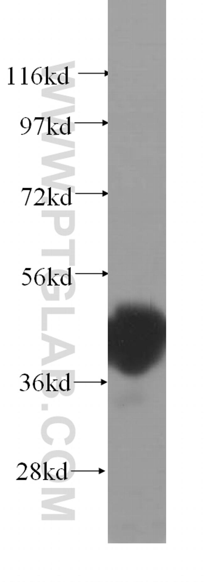 Cathepsin H Antibody in Western Blot (WB)