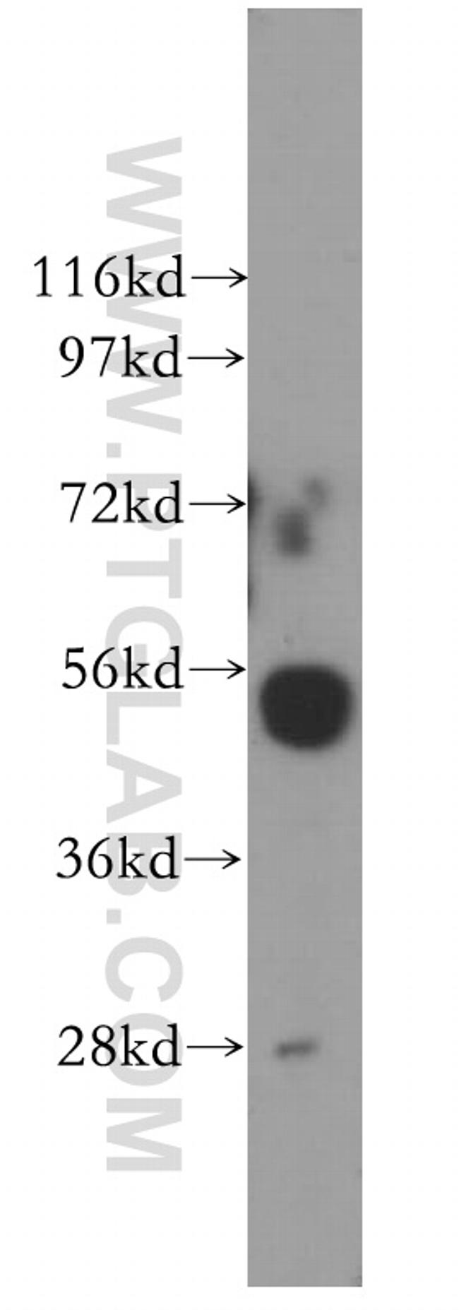 Cathepsin H Antibody in Western Blot (WB)