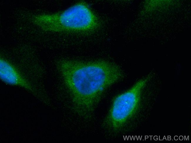 CRMP1 Antibody in Immunocytochemistry (ICC/IF)