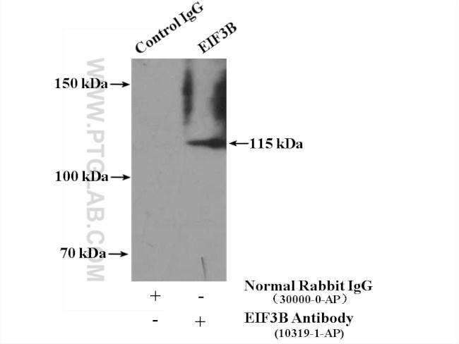 EIF3B Antibody in Immunoprecipitation (IP)