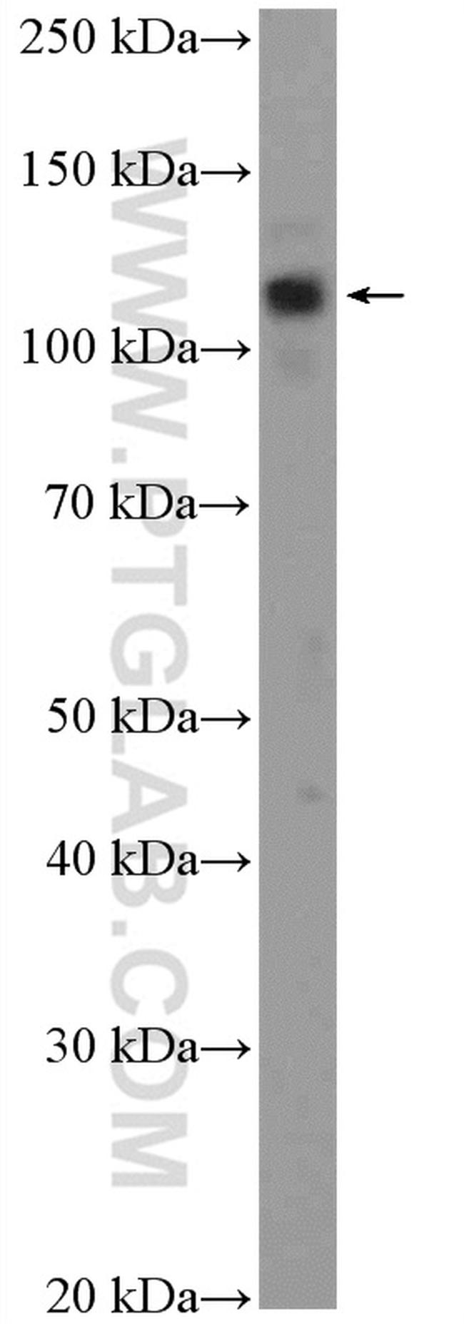 EIF3B Antibody in Western Blot (WB)