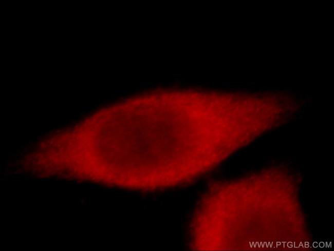 TCP1 Antibody in Immunocytochemistry (ICC/IF)