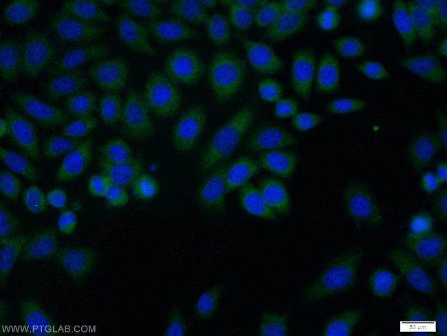 TCP1 Antibody in Immunocytochemistry (ICC/IF)