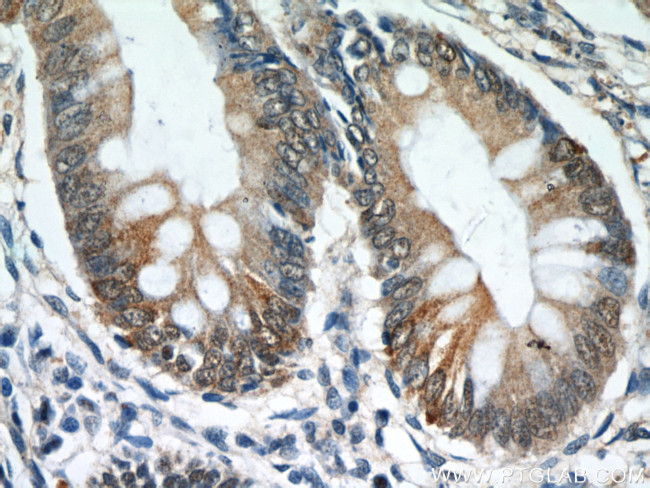 TCP1 Antibody in Immunohistochemistry (Paraffin) (IHC (P))